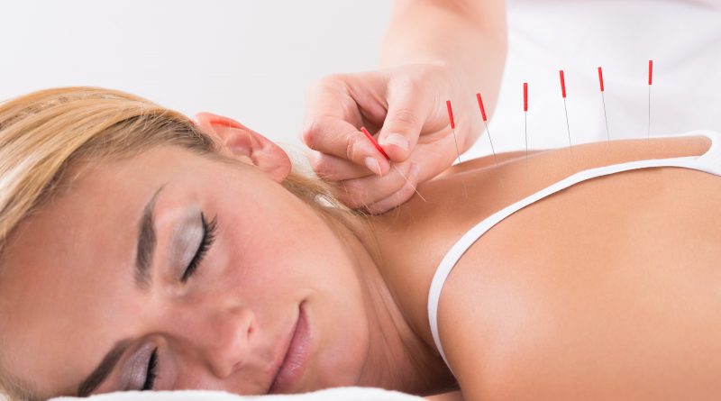 Hand Performing Acupuncture Therapy On Customer's Back